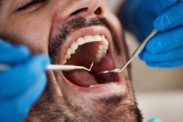 Best Emergency Treatment for Dental Infections or Abscesses in Heyburn, ID